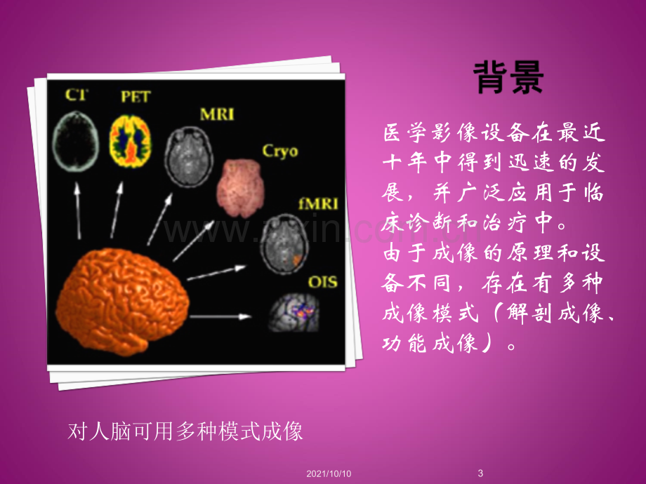 第7讲-医学图像配准和融合.ppt_第3页