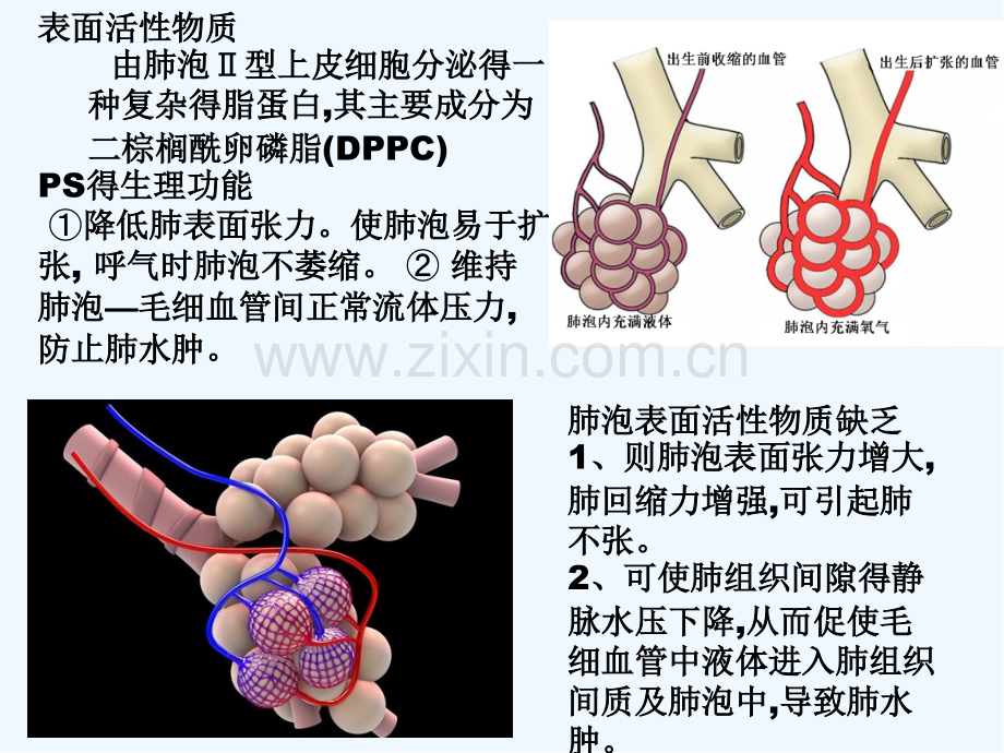 新生儿呼吸窘迫综合征有些总结ppt.pptx_第3页