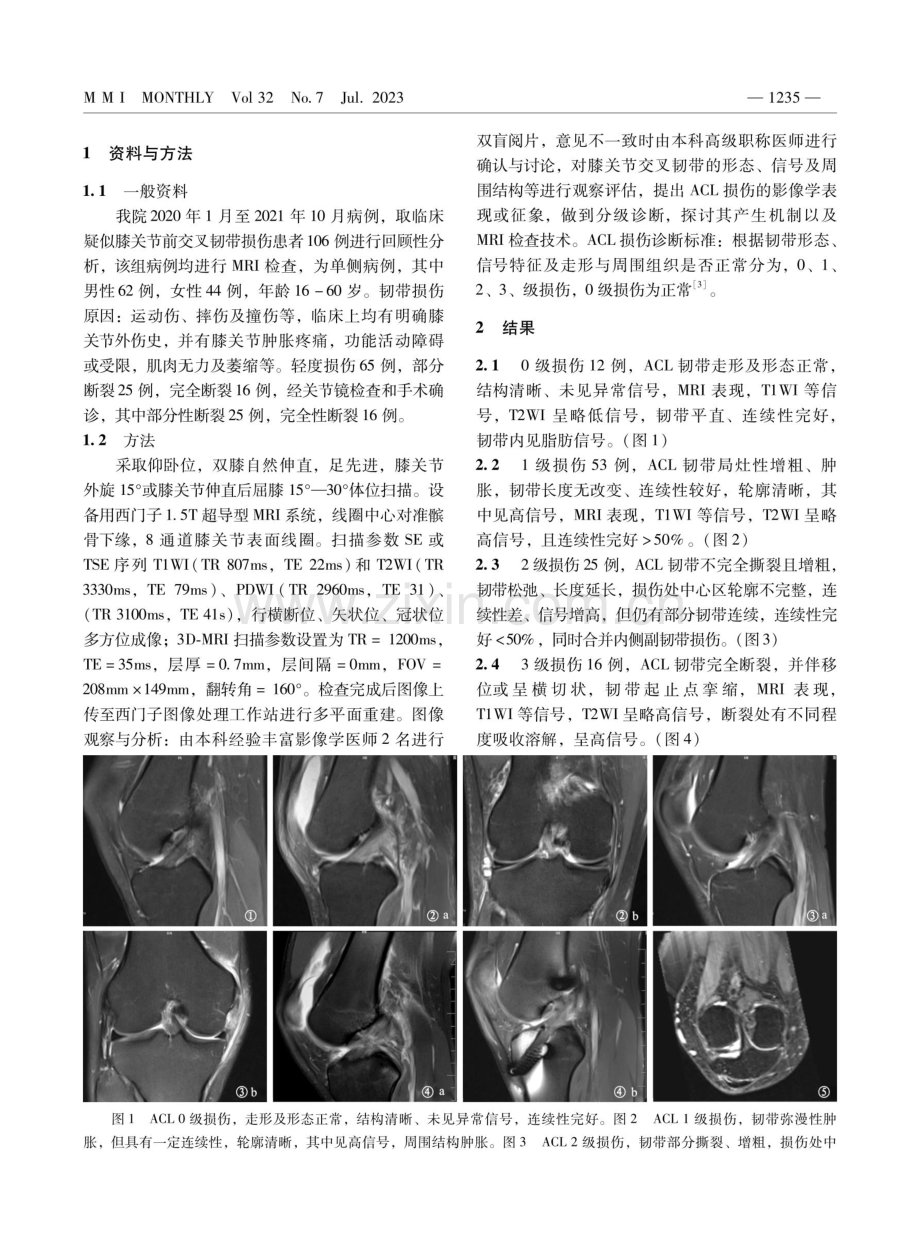 磁共振成像技术在膝关节前交叉韧带损伤中的应用.pdf_第2页