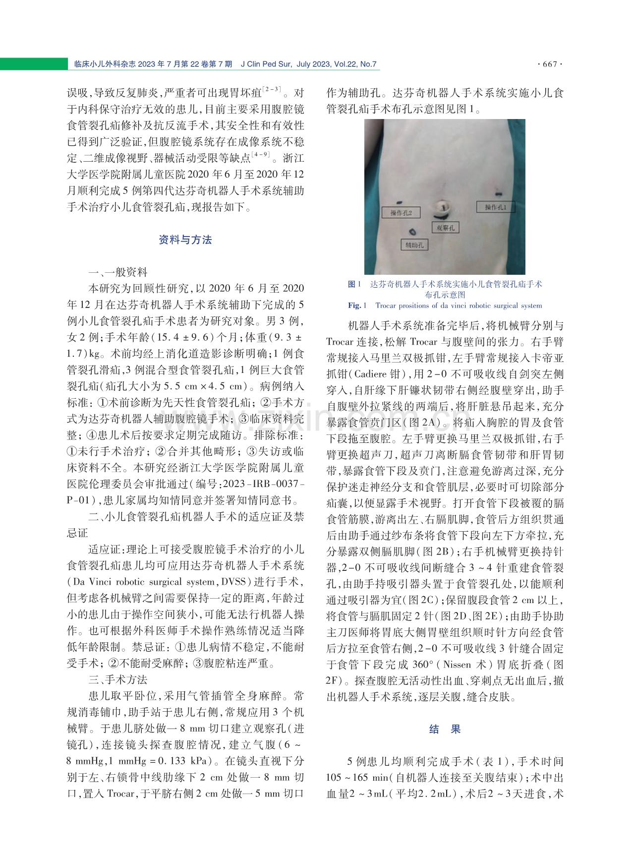 达芬奇机器人手术系统治疗小儿食管裂孔疝疗效与安全性分析.pdf_第2页