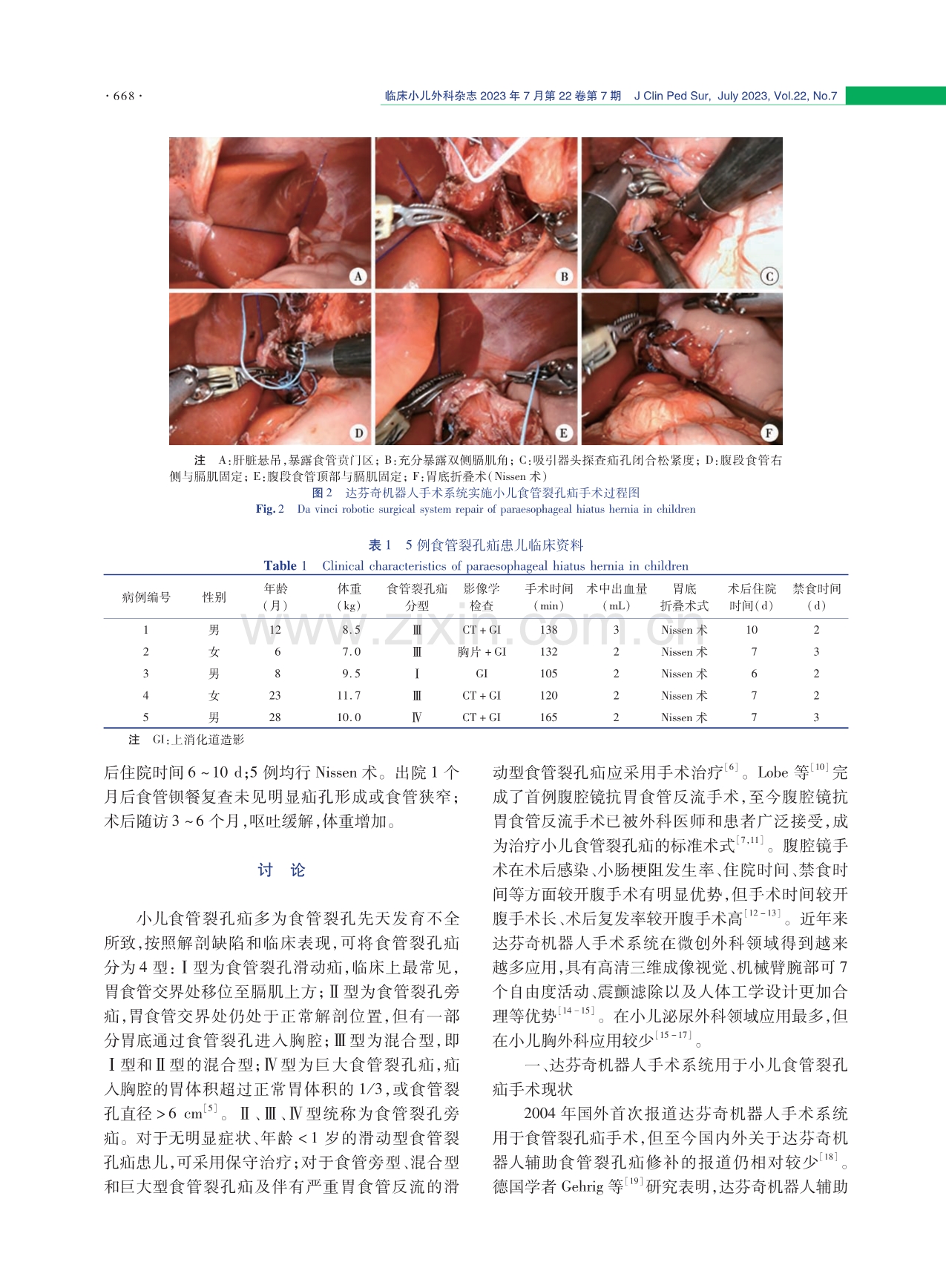 达芬奇机器人手术系统治疗小儿食管裂孔疝疗效与安全性分析.pdf_第3页