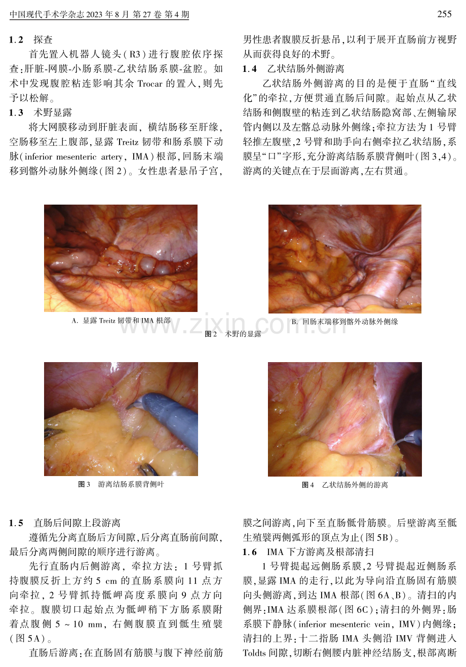 达芬奇机器人辅助直肠癌手术的流程化：单中心经验.pdf_第3页