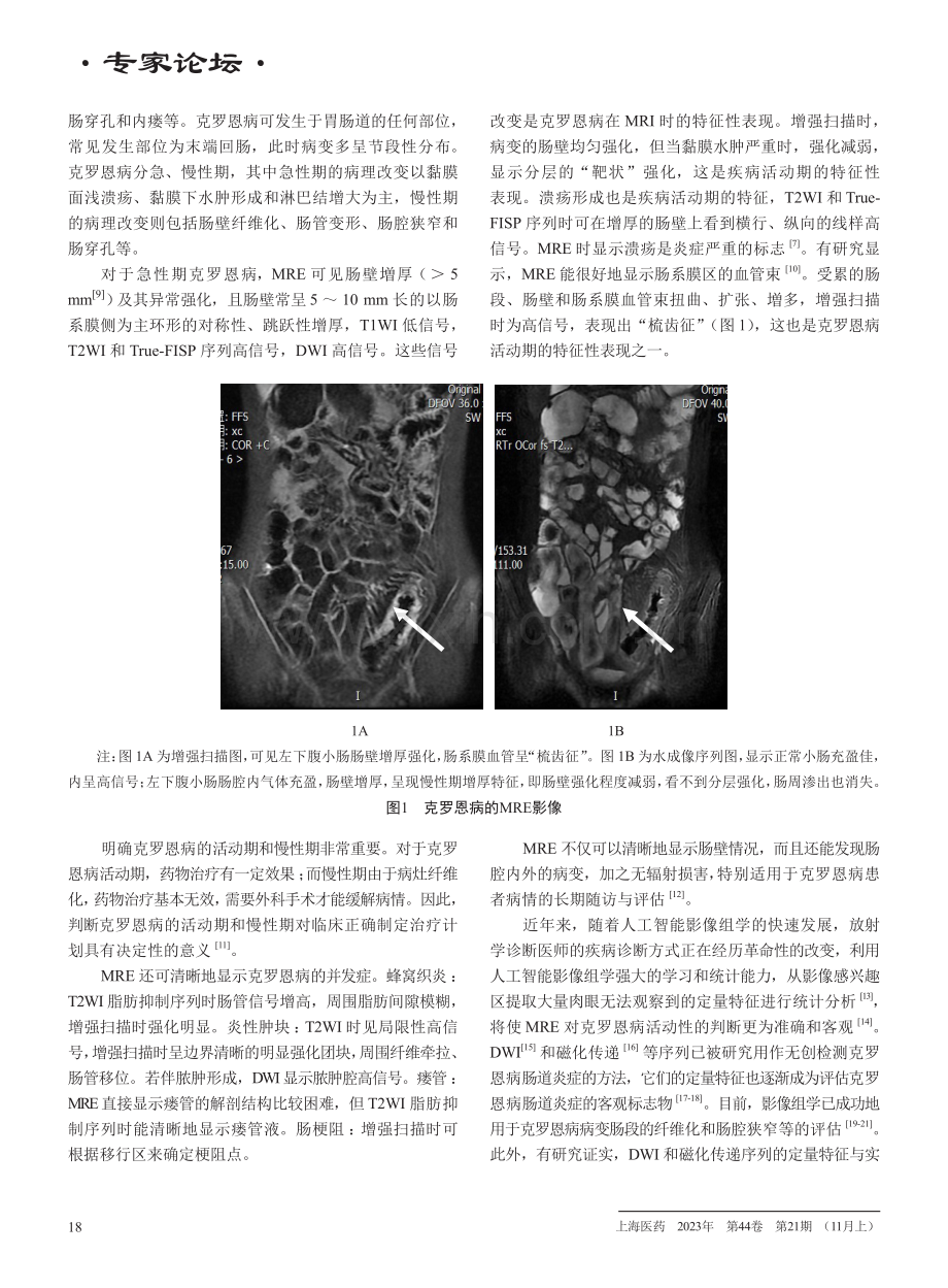 磁共振小肠造影的临床应用.pdf_第3页