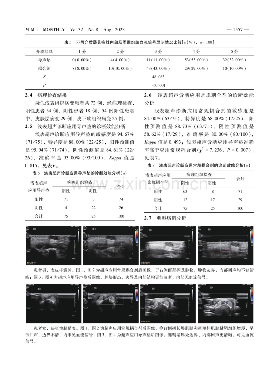 导声垫在浅表超声诊断中的临床研究.pdf_第3页