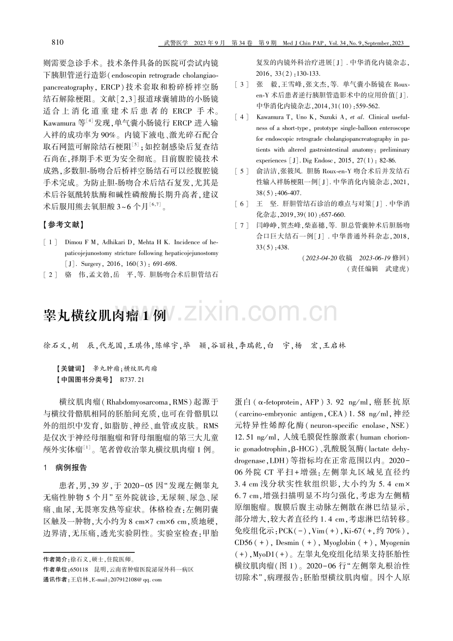 胆肠吻合术后桥袢空肠结石嵌顿1例.pdf_第2页