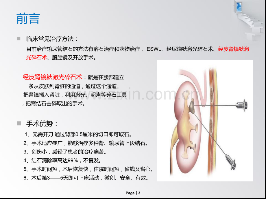 输尿管结石患者的护理查房1.pptx_第3页