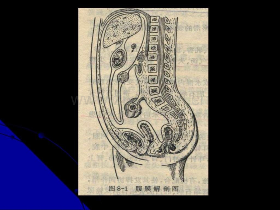 f急性化脓性腹膜炎.pptx_第3页