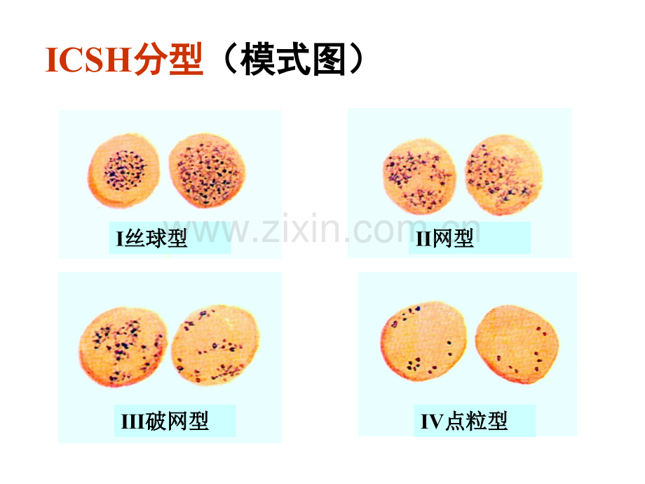 网织红细胞计数.pptx_第3页