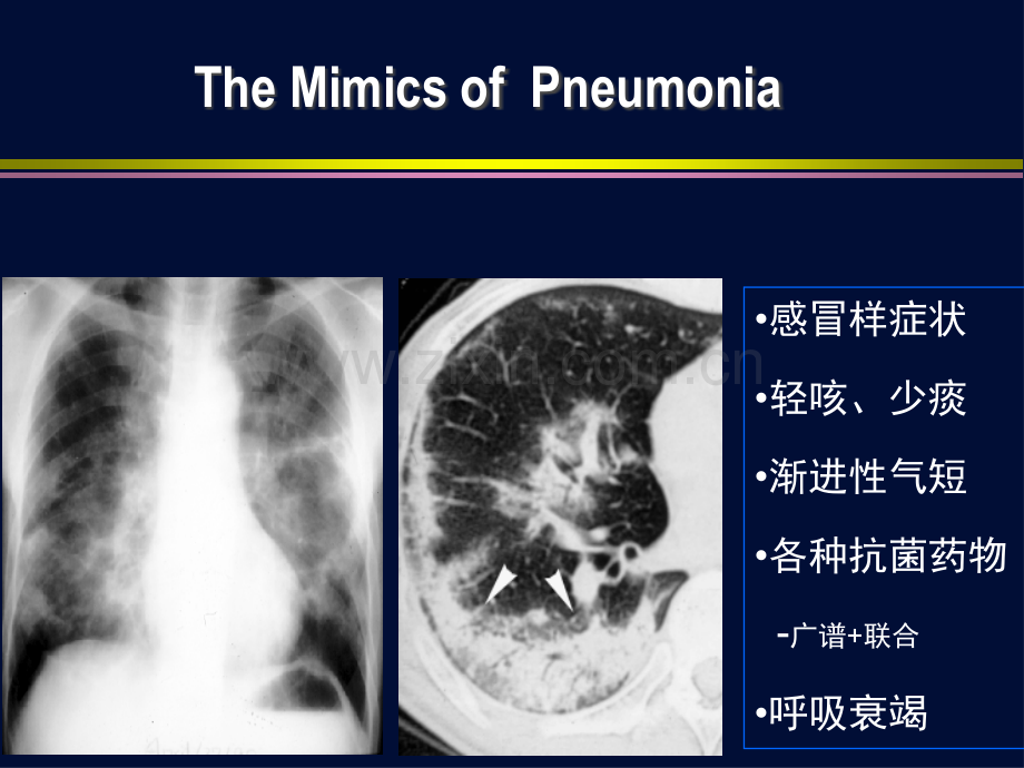 个体化抗菌治疗策略.ppt_第3页