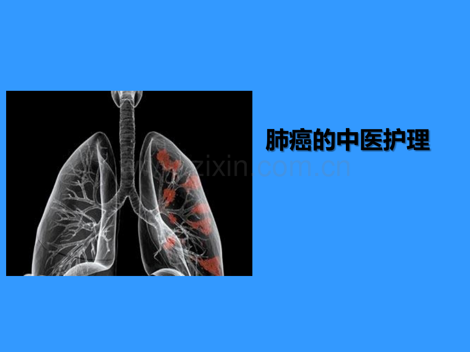 肺癌的中医护理.ppt_第1页