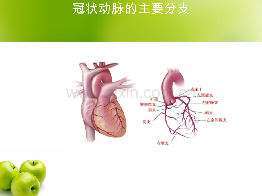 冠状动脉介入治疗的术前和术后护理.ppt_第3页