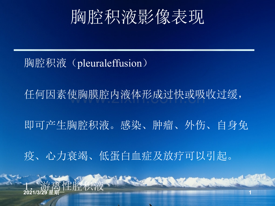 胸腔积液的影像诊断.ppt_第1页