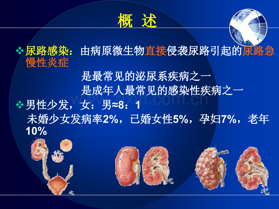 临床医学尿路感染病人的护理.pptx_第3页