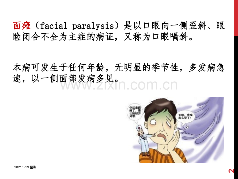 面瘫的针灸治疗.ppt_第2页