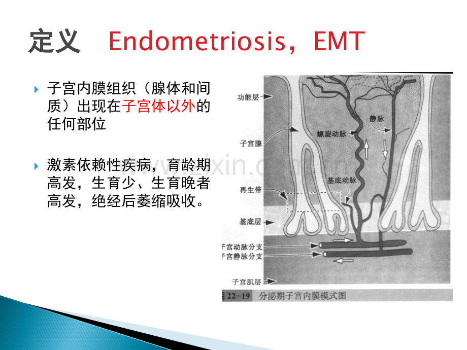 子宫内膜异位症2016.pptx_第2页