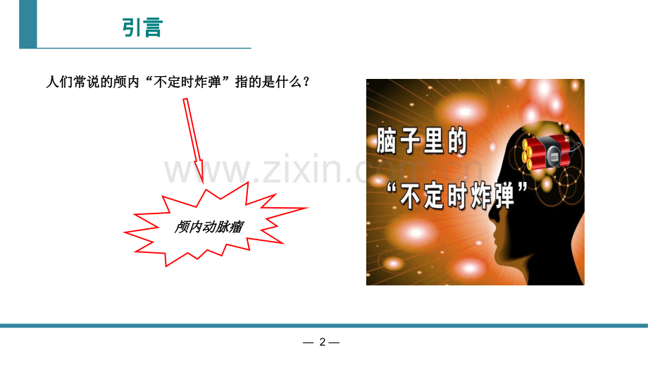 颅内动脉瘤CTA诊断.ppt_第2页