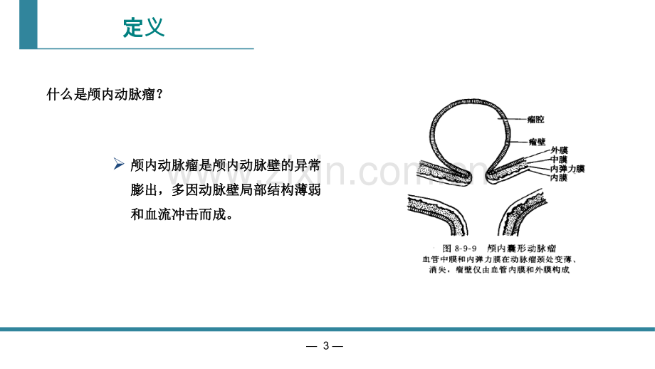 颅内动脉瘤CTA诊断.ppt_第3页