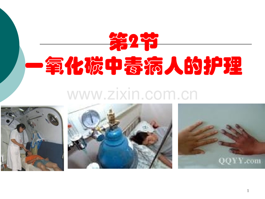 一氧化碳中毒病人的护理.pptx_第1页