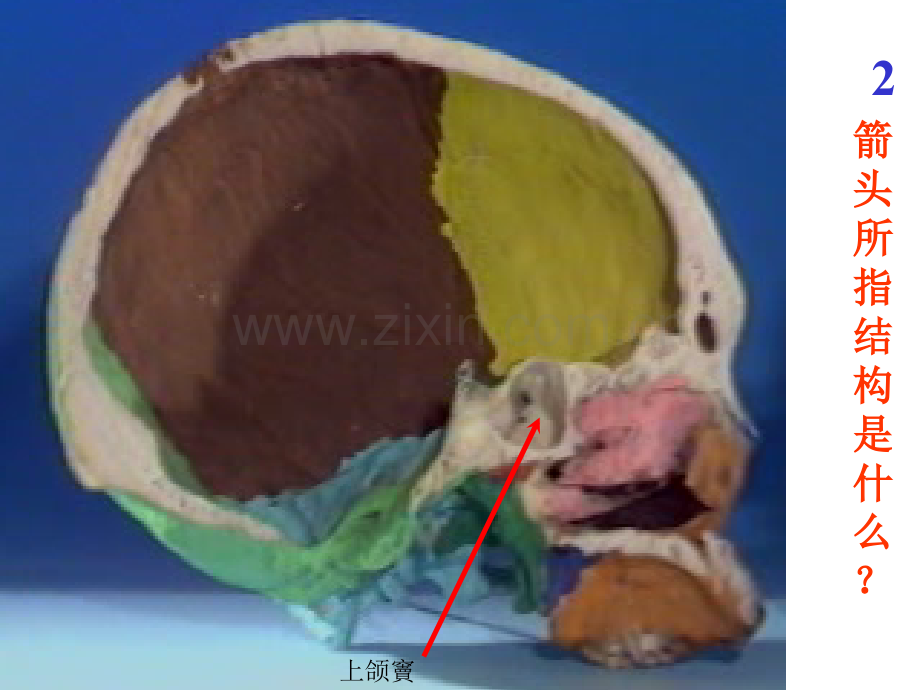 正常人体解剖学实验考试题库.pptx_第3页