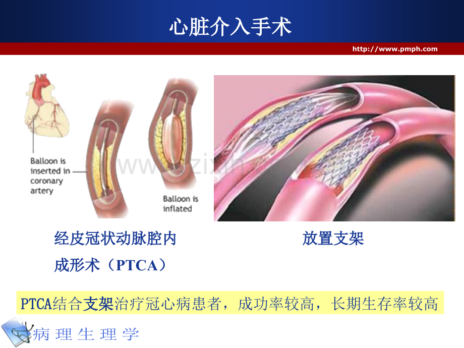 病理生理学IRI诱导自由基产生机制XO作用中性粒细胞呼吸爆发.ppt_第3页