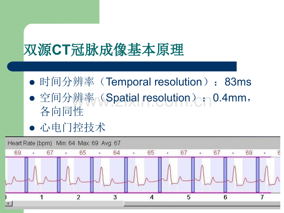 冠状动脉常见疾病的双源CT表现.ppt_第3页