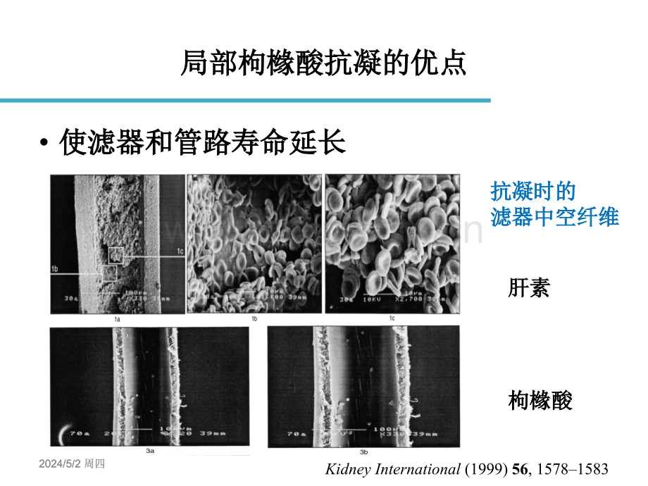 枸橼酸抗凝.ppt_第3页