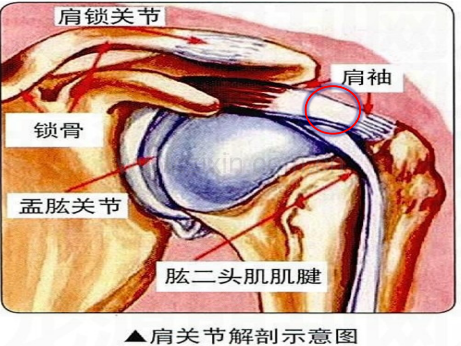 肩袖损伤护理.ppt_第2页