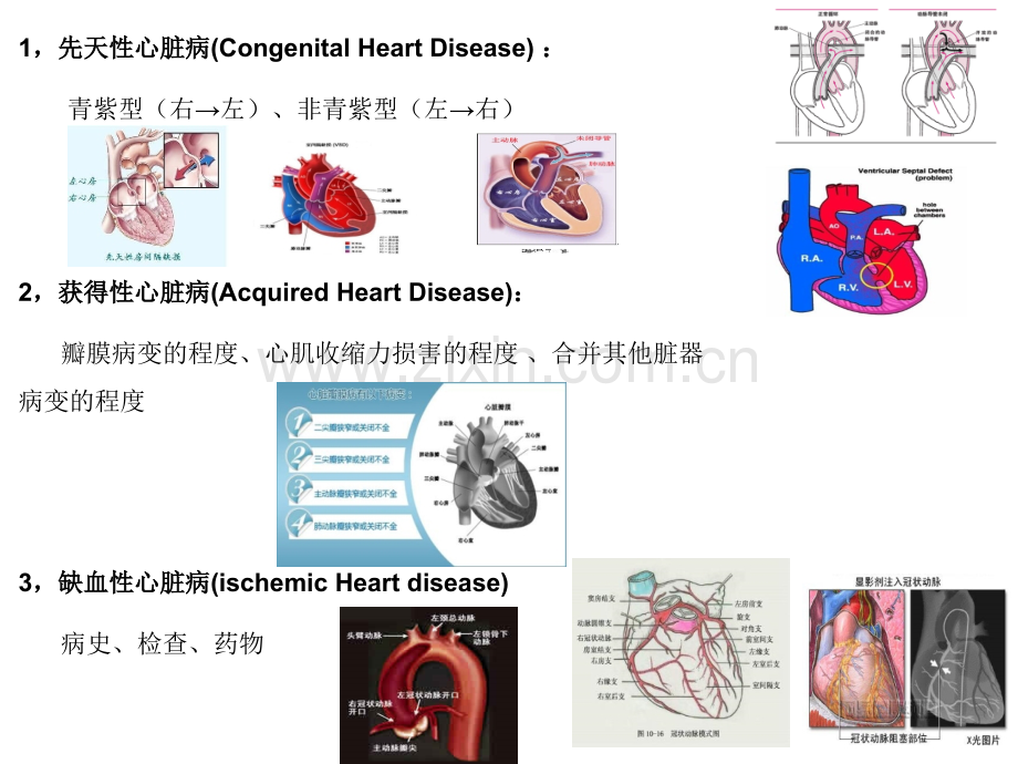 心脏病人的麻醉.ppt_第2页