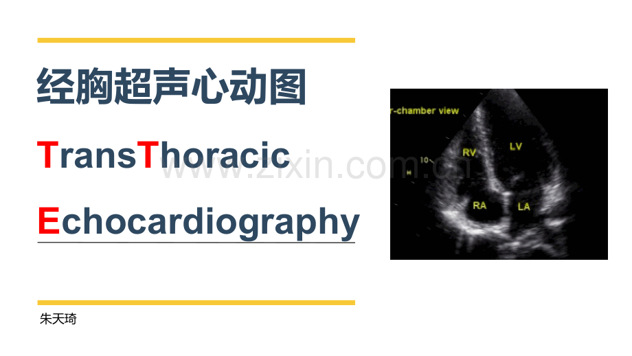 经胸超声心动图.ppt_第1页