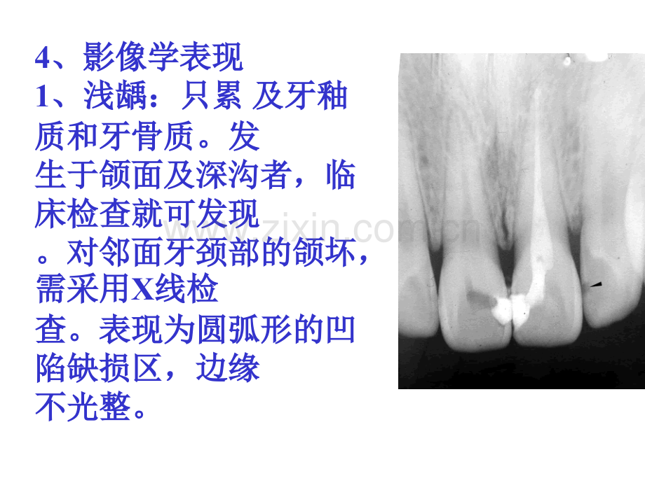 口腔颌面常见病诊断.ppt_第3页