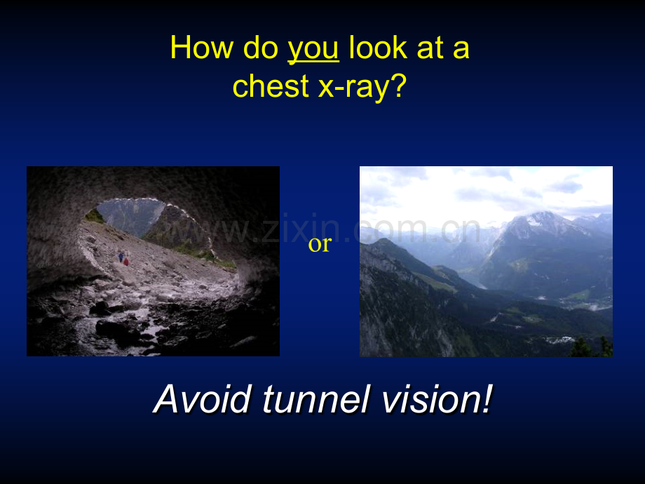 医学ppt--basicchestxraymodadam.ppt_第2页