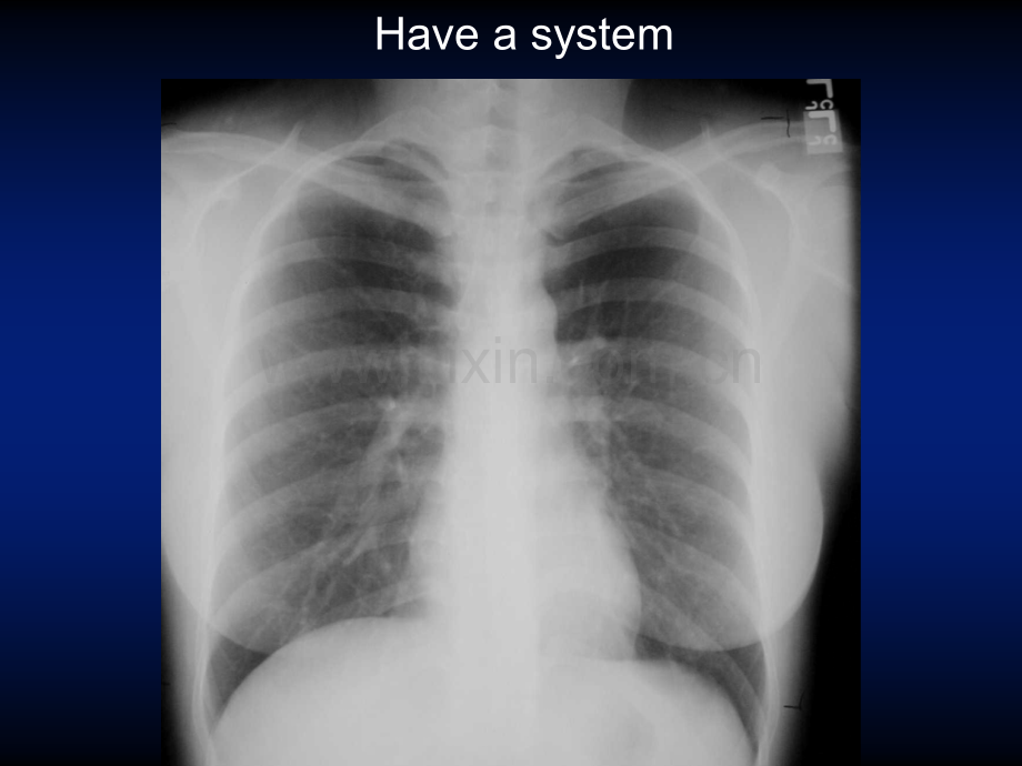 医学ppt--basicchestxraymodadam.ppt_第3页