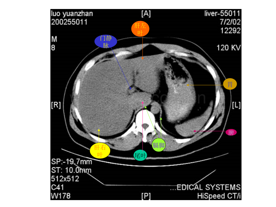 临床医师学习腹部CT.ppt_第3页
