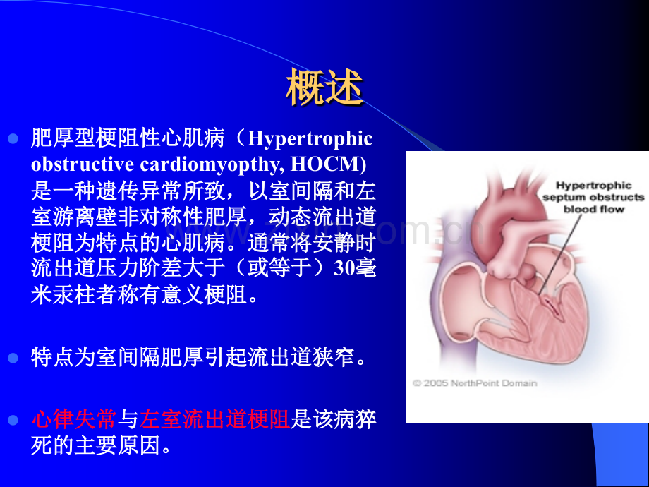 肥厚型梗阻性心肌病人的麻醉.ppt_第3页