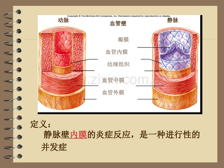 输液性静脉炎的研究.ppt_第2页