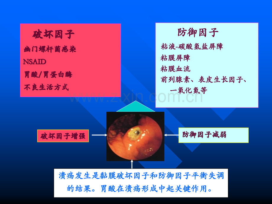 浅述胃粘膜防御因子在消化性溃疡中的作用.ppt_第2页