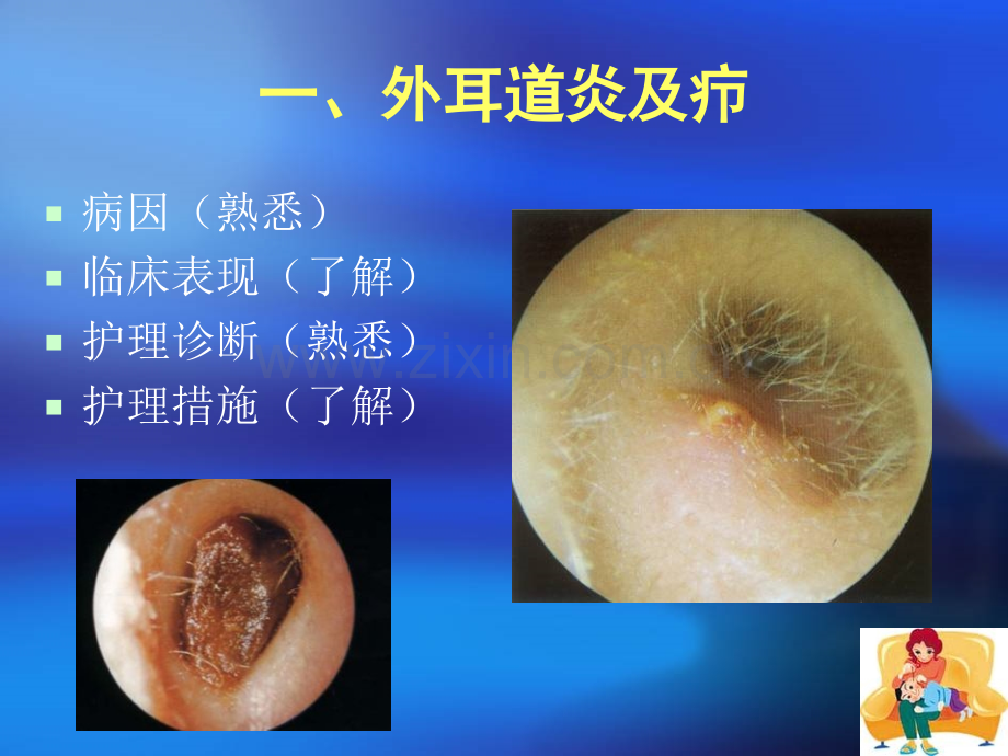 耳部常见疾病患者的护理.ppt_第3页