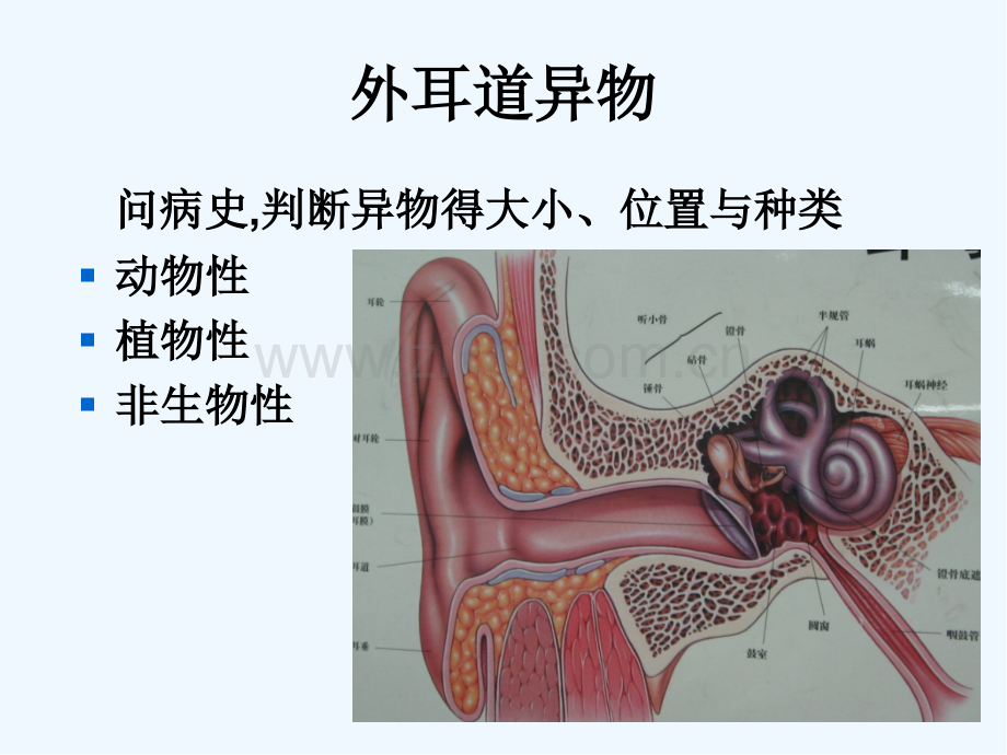 耳科常见急症处理PPT.pptx_第3页