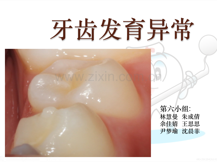 牙齿发育异常.pptx_第1页