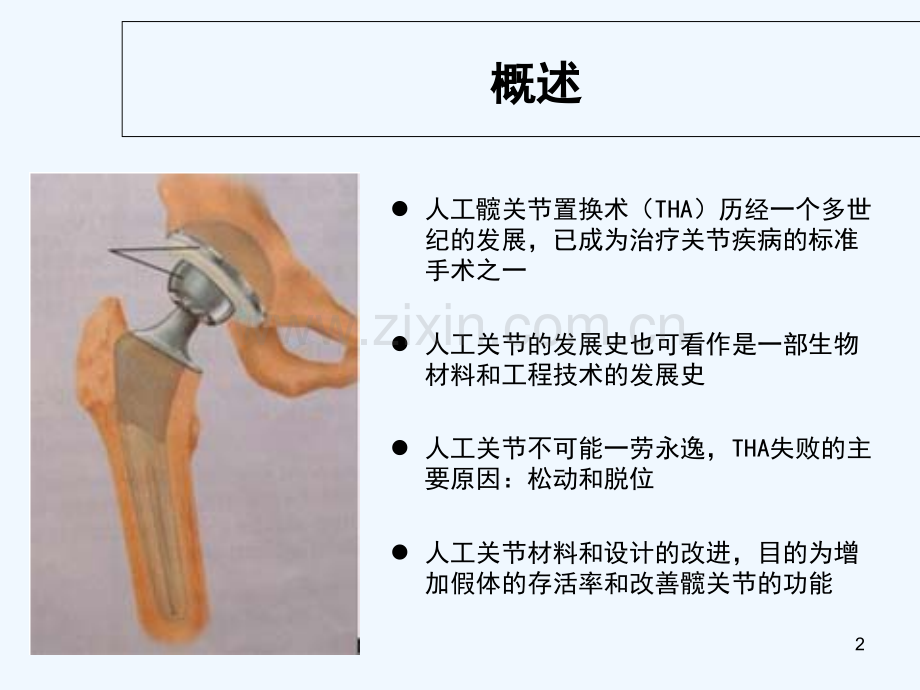 人工髋关节假体材料-PPT.ppt_第2页