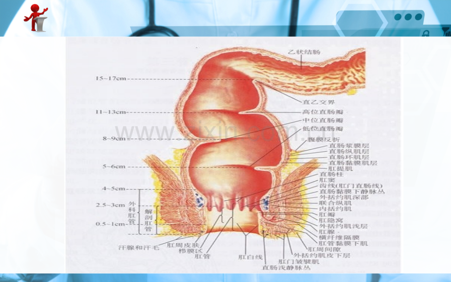 《外科护理》第十五章-第六节-直肠肛管良性疾病病人的护理.ppt_第3页