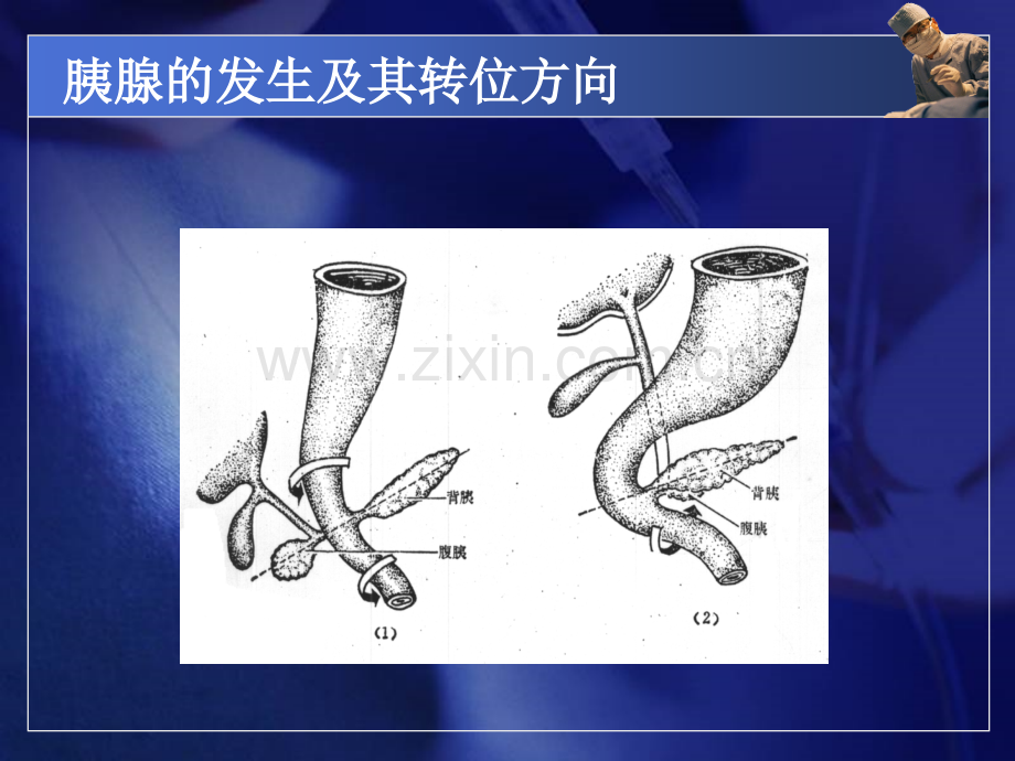 急性胰腺炎小讲课指导.ppt_第3页