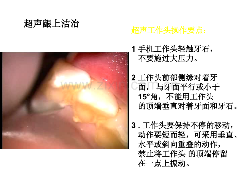 牙-周-病-学-第四版-9.ppt_第3页