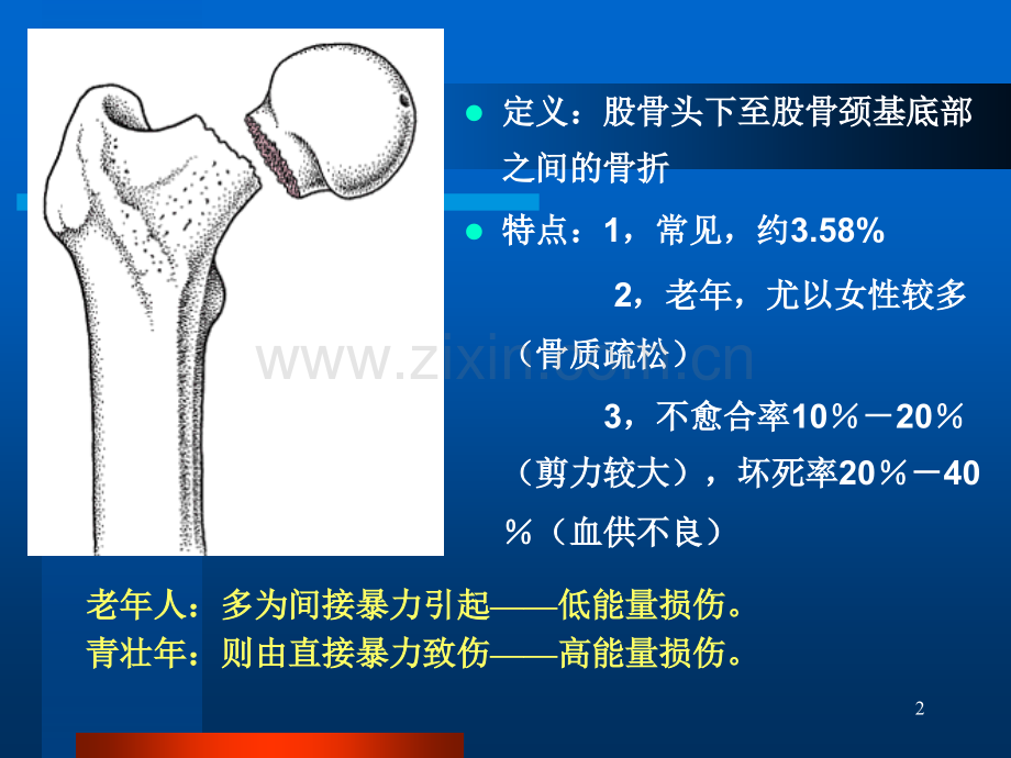 股骨颈骨折治疗选择.ppt_第2页