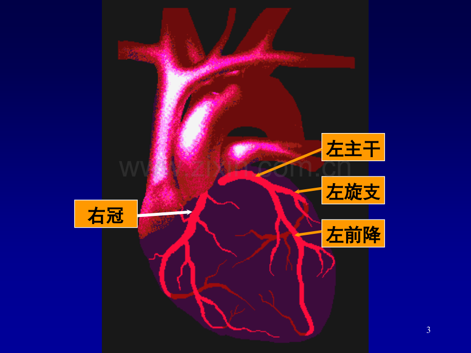 急性心肌梗塞.ppt_第3页