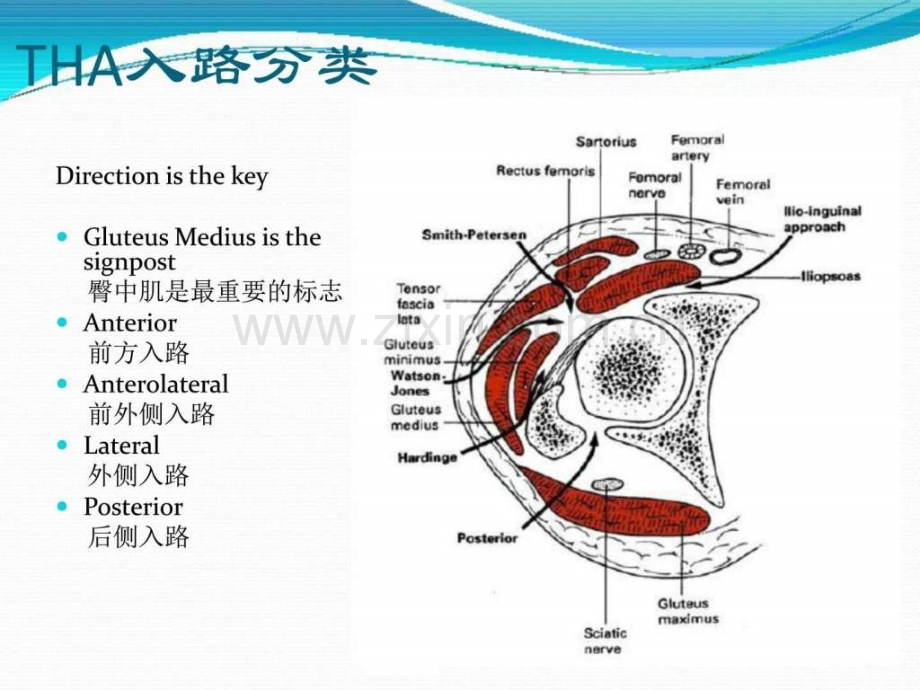 直接前方入路髋关节置换图文.ppt_第3页