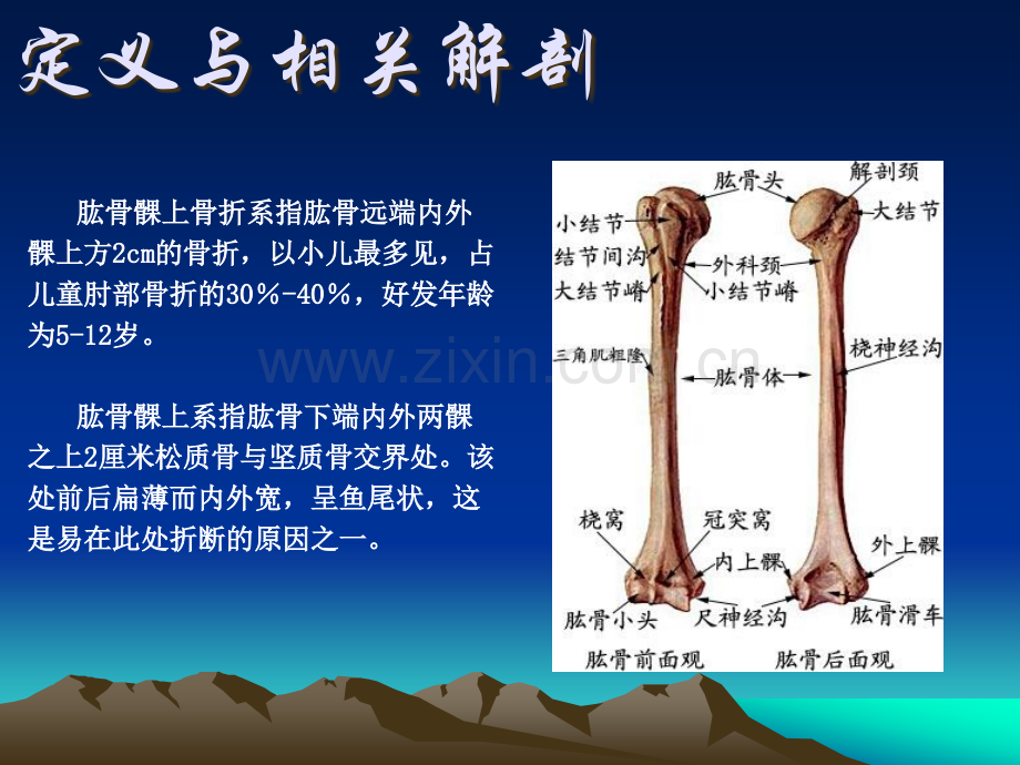 肱骨髁上骨折.ppt_第2页