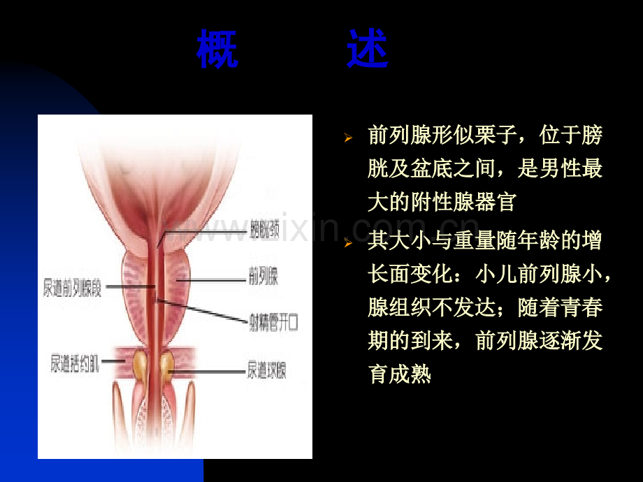 前列腺炎诊疗现状与进展-厦门长庚医院.ppt_第3页