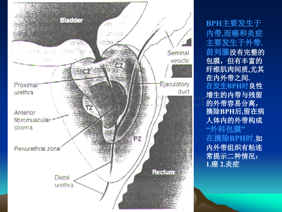 前列腺讲课.ppt_第3页