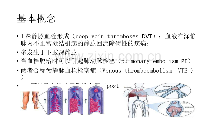 急性深静脉血栓形成的诊断和管理.pptx_第3页